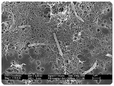 The rod-shaped D. audaxviator was recovered from thousands of liters of water collected deep in the Mponeng Mine in South Africa. (Micrograph by Greg Wanger, J. Craig Venter Institute, and Gordon Southam, University of Western Ontario, used with permission) 