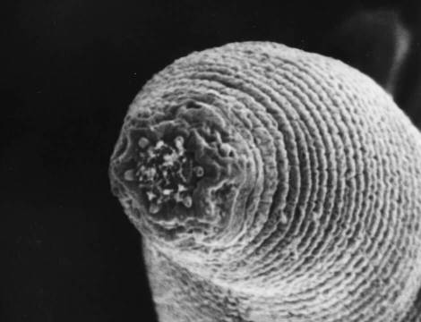 Halicephalobus mephisto, the first multicellular organism found far below Earth’s surface, is a ravenous bacteria eater. (Borgonie, University of the Free State)